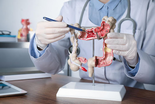 Medico explicando que es la colonoscopia